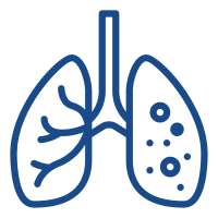 Tuberculosis Infection