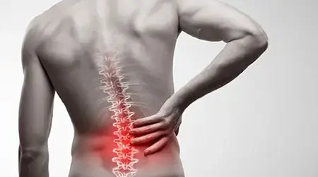 Back Pain