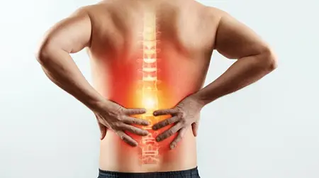 Back Stiffness