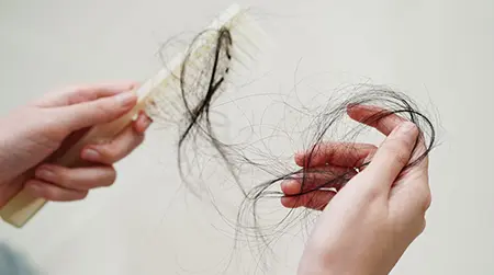 Excess Hair Loss
