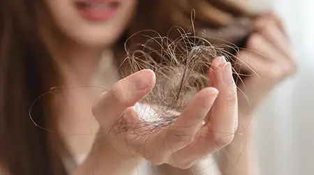 Hair Loss