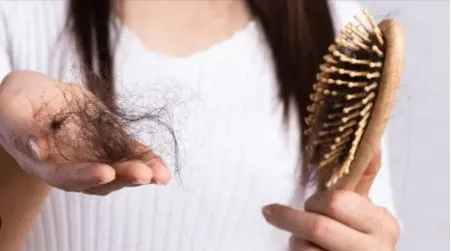 Hairfall