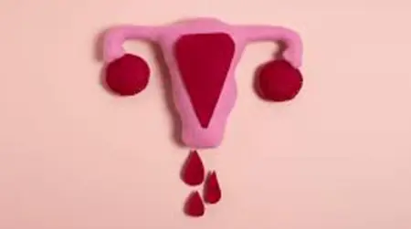 Heavy Bleeding