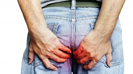 Itching anus