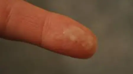 Mucus discharge