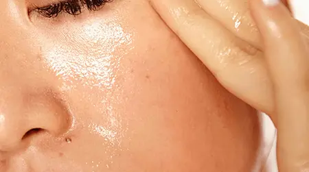 Oily Skin