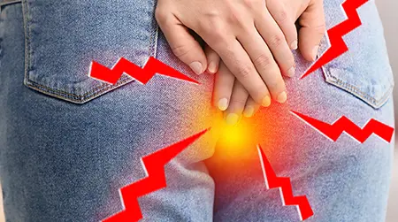Swollen anus