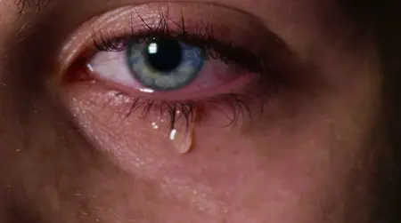 Watery eyes