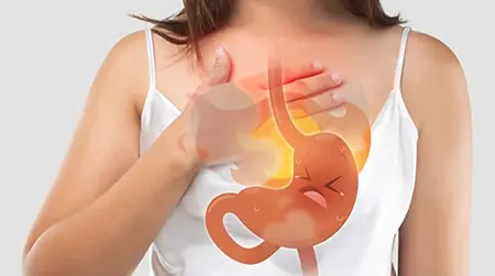 Chronic   Acidity