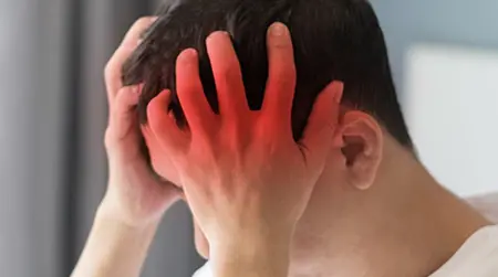 Cluster Headache