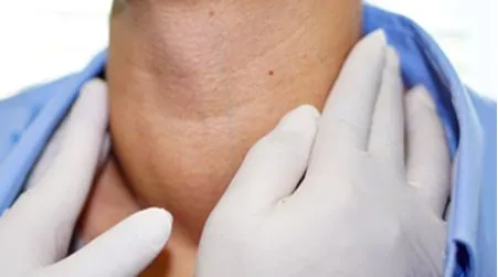 Goiter Condition