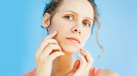 Hormonal Imbalance