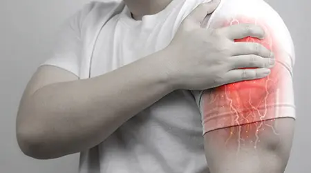 Muscle Strain