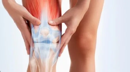 Osteoarthritis Type