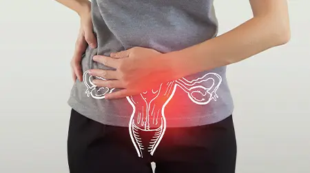 PCOS Problem