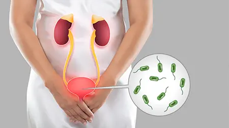 Urinary Infection